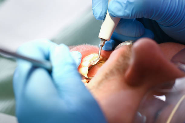 Best Emergency Dental Care for Abscessed Tooth in Webberville, MI
