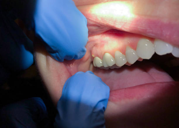 Best Emergency Cosmetic Dentistry in Webberville, MI