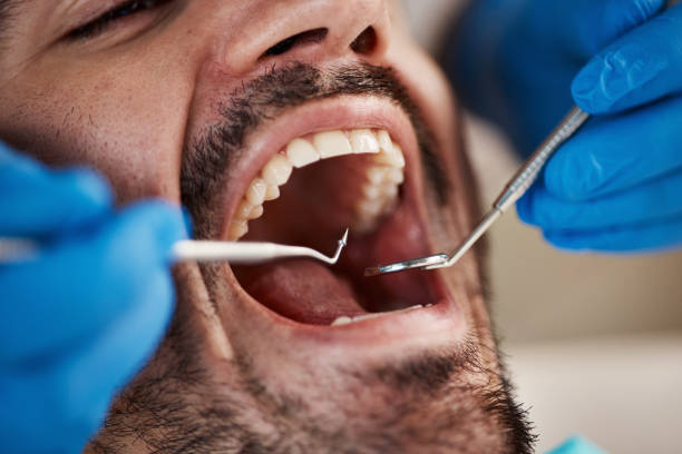 Best Mobile Emergency Dentist in Webberville, MI