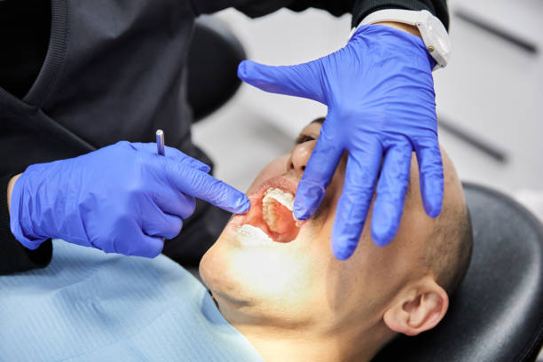 Best Emergency Dentist for Lost Fillings or Crowns in Webberville, MI